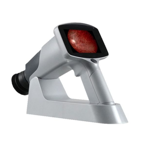 Przenośna funduskamera FC-161 – kompaktowe urządzenie do obrazowania dna oka z wbudowanym ekranem i uchwytem diagnostycz